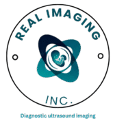A minimalist, circular logo for Real Imaging, Inc. is centered on a black background. The name "REAL IMAGING" curves around the top half of the outer ring in a cyan-blue color. In the center is an abstract, stylized atom or cellular structure, composed of three interlocking, transparent ovals in gradient shades of dark blue and teal/cyan, representing movement and diagnostic depth. Below the central graphic, the letters "INC." are positioned, and the tagline "Diagnostic ultrasound imaging" is centered at the very bottom in smaller, cyan text.